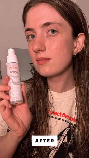 Blackman after applying the Eau Thermale Avène RetrinAL 0.1 Intensive Cream